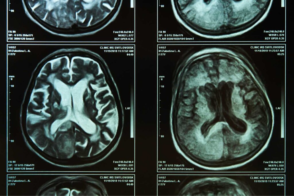 Pie Medical Imaging